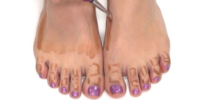 foot-contouring